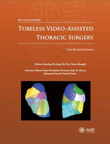 Tubeless Video-Assisted Thoracic Surgery (The Second Edition)