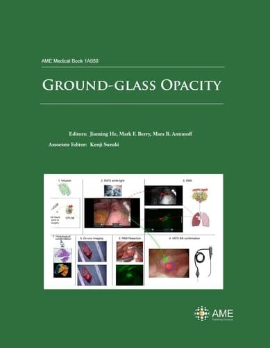 Ground-glass Opacity