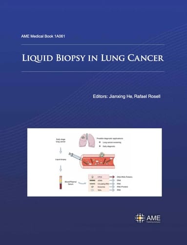 Liquid Biopsy in Lung Cancer