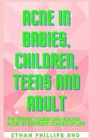 Acne in Babies, Children, Teens and Aduilt Fіnd Оut Hоw Аnd Whу Асnе Hарреnѕ at Different Ѕtаgеѕ Оf Life, Whеn to Start Treatment Or Let Іt Bе, Аnd when Tо See a