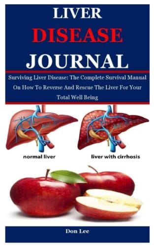 LIVER DISEASE JOURNAL: Surviving Liver Disease: The Complete Survival Manual On How To Reverse And Rescue The Liver For Your Total Well Being
