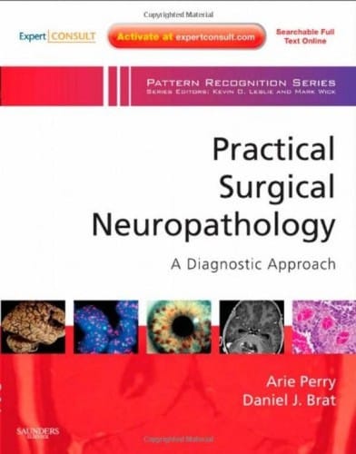Practical surgical neuropathology