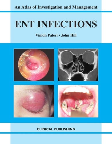 ENT infections