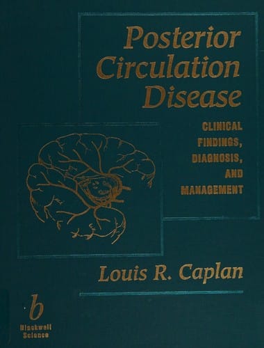 Posterior circulation disease