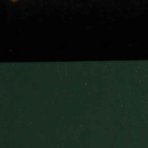 Surgical treatment of digestive disease