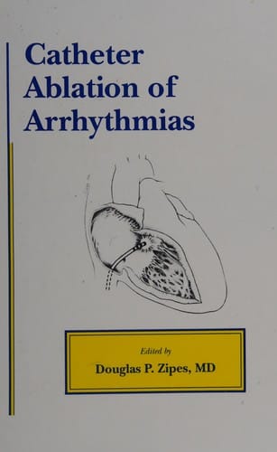 Catheter ablation of arrhythmias