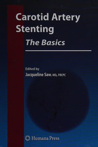 Carotid artery stenting