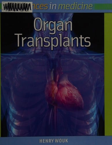 Organ transplants