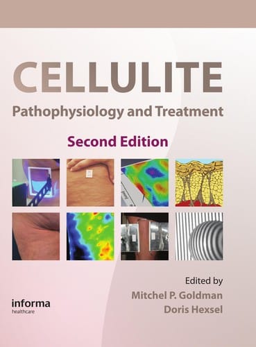 Cellulite