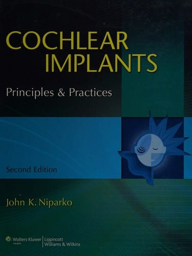 Cochlear implants