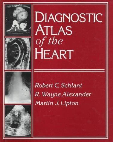 Diagnostic atlas of the heart