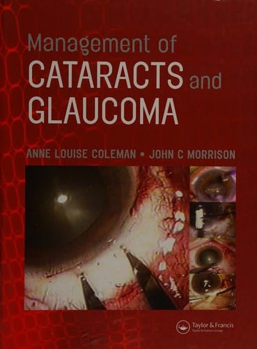 Management of cataracts and glaucoma