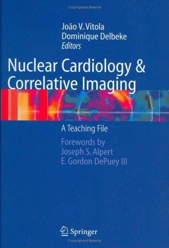 Nuclear cardiology and correlative imaging