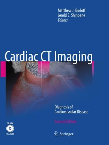Cardiac CT imaging