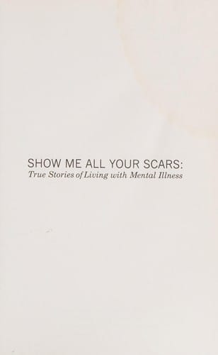 Show me all your scars
