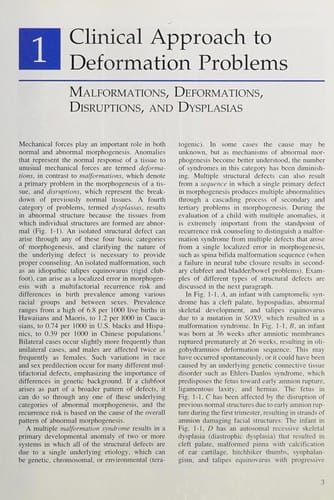 Smith's recognizable patterns of human deformation