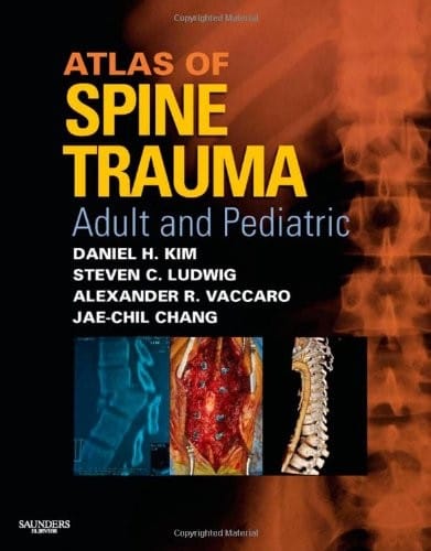Atlas of spine trauma
