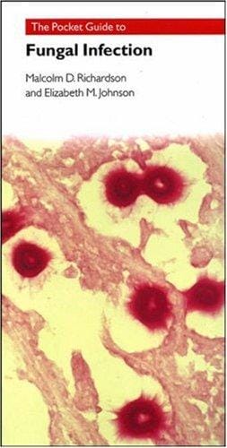 The Pocket Guide to Fungal Infection
