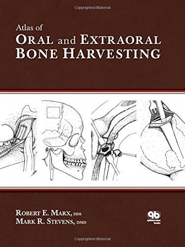 Atlas of oral and extraoral bone harvesting