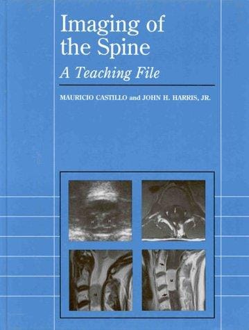 Imaging of the spine