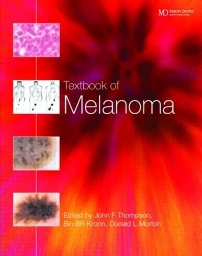 Textbook of melanoma