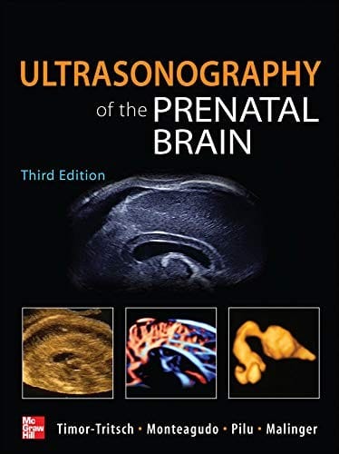 Ultrasonography of the prenatal and neonatal brain