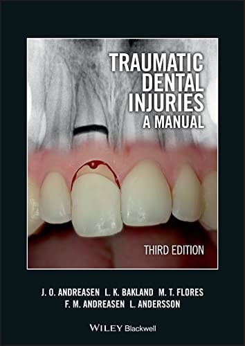 Traumatic dental injuries