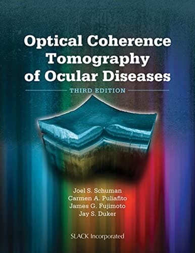 Optical coherence tomography of ocular diseases