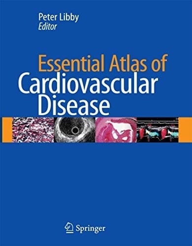 Essential atlas of cardiovascular disease