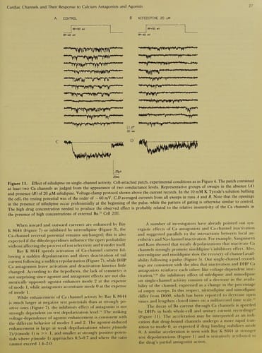 Cardiac electrophysiology and arrhythmias