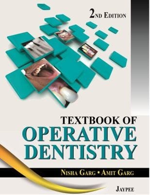 Textbook of operative dentistry