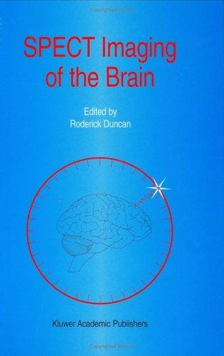 SPECT imaging of the brain