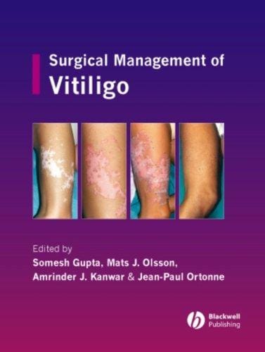 Surgical management of vitiligo