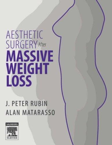 Aesthetic surgery after massive weight loss