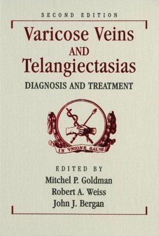 Varicose veins and telangiectasias