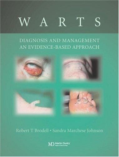 Warts