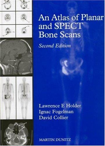 An atlas of planar and SPECT bone scans