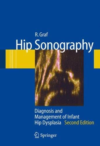 Hip sonography