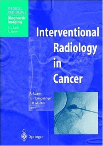 Interventional radiology in cancer