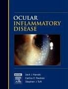 Ocular inflammatory disease