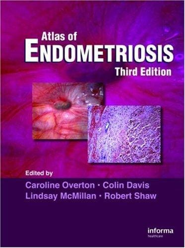 An atlas of endometriosis