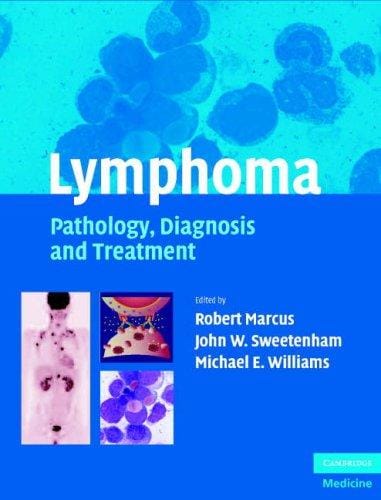 Lymphoma