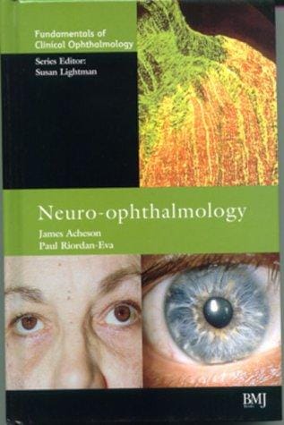 Neuro-ophthalmology