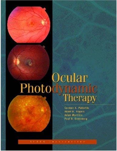 Ocular photodynamic therapy