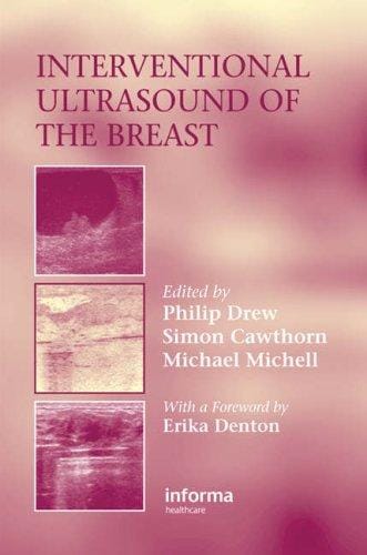 Interventional ultrasound of the breast