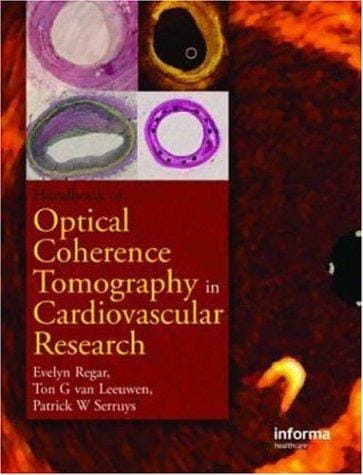 Optical coherence tomography in cardiovascular research