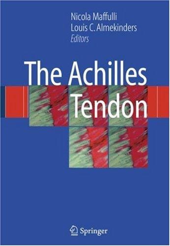 The Achilles tendon