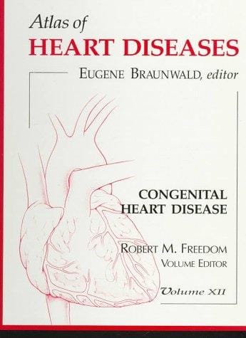 Congenital heart disease
