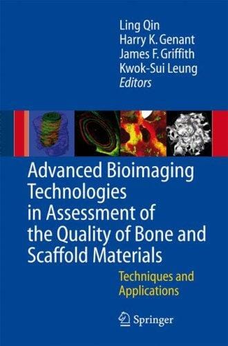 Advanced bioimaging technologies in assessment of the quality of bone and scaffold materials