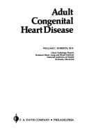 Adult congenital heart disease
